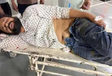 Lucknow Firing News, BJP Leader Shot in Lucknow, Shyam Chetan Tiwari News, BJYM Leader Firing Case, Mehndiganj Shooting Incident, Uttar Pradesh Crime News, BJP Worker Shot, Poster Dispute Firing, Lucknow Police Investigation, Vaibhav Bajpai Accused, UP Crime Update, Lucknow Breaking News, BJP Leader Attack,भाजपा नेता घायल फोटो, लखनऊ गोलीकांड तस्वीरें, मेहंदीगंज फायरिंग स्थल, ट्रॉमा सेंटर लखनऊ, भाजपा कार्यकर्ता हमला, पुलिस जांच मौके की तस्वीरें, यूपी क्राइम फोटो, गोलीबारी घटना इमेज,BJP leader injured images, Lucknow firing scene photos, Mehndiganj shooting visuals, Trauma Center Lucknow images, BJP worker attack pictures, UP police investigation photos, crime scene visuals, Lucknow firing incident images,#Lucknow #BJPLeader #ShyamChetanTiwari #LucknowFiring #UPCrime #BJYM #BreakingNews #UttarPradesh #CrimeNews #LucknowPolice #BJP #Mehndiganj #VaibhavBajpai #FiringCase #PoliticalNews #UPNews #IndiaNews #CrimeUpdate #ShotAt #LucknowCrime