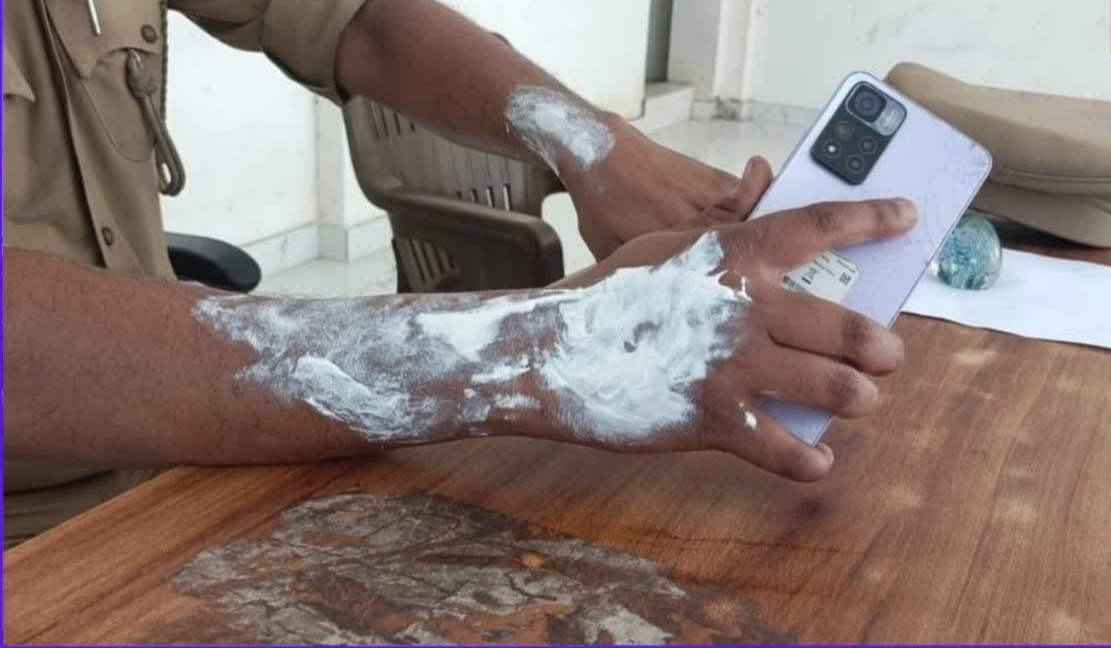 कानपुर थाना आत्मदाह, कानपुर न्यूज, महाराजपुर थाना, महाराजपुर थाना आत्मदाह, जनार्दन सिंह, कानपुर पुलिस, थाना प्रभारी घायल, पुलिसकर्मी झुलसे, पति पत्नी विवाद, आत्मदाह प्रयास, उत्तर प्रदेश क्राइम न्यूज, कानपुर अपराध समाचार, एसीपी चकेरी, आशुतोष सिंह, उत्तर प्रदेश पुलिस,Kanpur Police Station Self Immolation, Kanpur News, Maharajpur Police Station, Kanpur Crime News, Janardan Singh SHO, Police Officers Injured, Self Immolation Attempt, Uttar Pradesh Crime, ACP Chakeri Ashutosh Singh, Kanpur Police, UP Police News, Domestic Dispute Kanpur,Kanpur Police Station Photo, Maharajpur Thana, Self Immolation Incident, Injured Police Officers, SHO Janardan Singh, Kanpur Police, Hospital Treatment, UP Crime News,#Kanpur, #KanpurNews, #MaharajpurThana, #KanpurPolice, #SelfImmolation, #UPPolice, #CrimeNews, #JanardanSingh, #AshutoshSingh, #UttarPradesh, #BreakingNews,