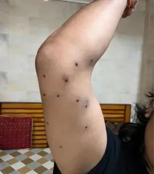 संसद मार्च पैलेट गन वीडियो, RAF जवान कौन है, CRPF जांच रिपोर्ट, छात्रों पर पैलेट गन क्यों चली, दिल्ली छात्र प्रदर्शन, NEET आंदोलन अपडेट, संसद मार्च हिंसा खबर, पैलेट गन फायरिंग केस, नई दिल्ली,Parliament March Pellet Gun Case, RAF Jawan Pellet Gun Firing, CRPF Investigation, Delhi Student Protest, NEET Protest News, Parliament March Violence, Pellet Gun Firing Delhi, Connaught Place Protest, Student Movement India,Parliament March Pellet Gun Video, RAF Jawan Identified, CRPF Investigation Report, Pellet Gun Used On Students, Delhi Student Protest Update, NEET Protest News, Parliament March Violence Case, New Delhi,